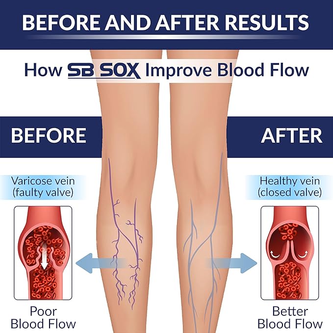 SB SOX Compression Socks for Men & Women (20-30 mmHg) - Best Support Stockings for Travel, Medical, and Sports - Perfect for Everyday Wear
