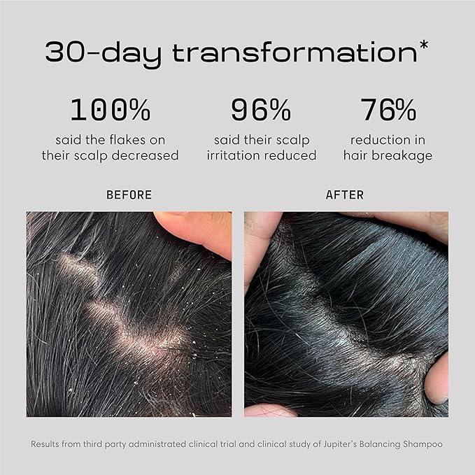 Jupiter, Physician-Formulated Anti-Dandruff Shampoo & Conditioner, for Flaky, Itchy, Oily, Dry Scalp, Vegan, Sulfate-Free, Color-Safe, & Paraben-Free, Dry Scalp Shampoo and Conditioner for Women & Men